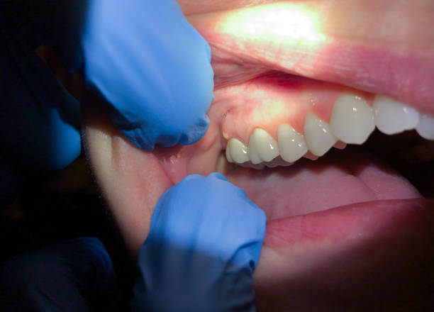 Best Emergency Dental Surgery in Charles City, IA