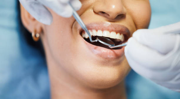 Best Emergency Broken Tooth Repair in Charles City, IA